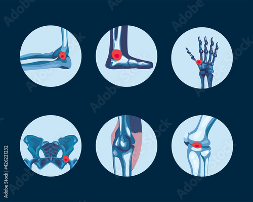 Rheumatology symbol collection