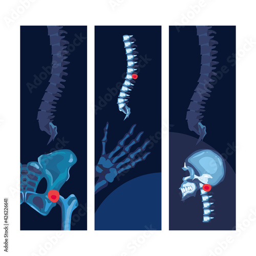 Rheumatology posters set