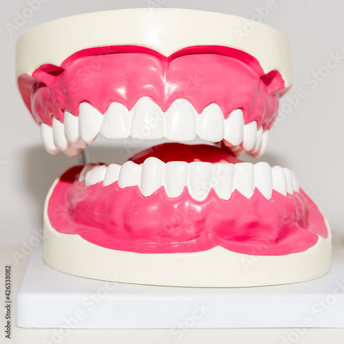 Biss, Kiefermodell, Kiefreform bei einem Zahnarzt, Zähne und Zahnfleisch, Nahaufnahme.