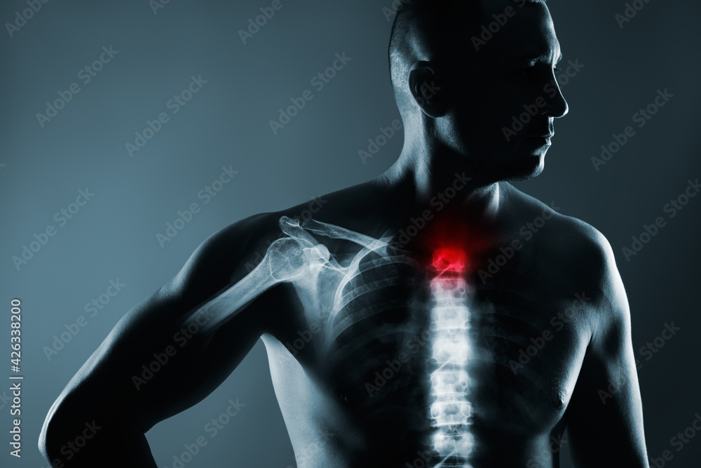 Human spine in x-ray on gray background. Human spine in x-ray on gray background.