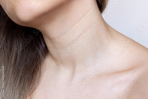 A close-up view of a young woman's neck and chest. Lines on the neck. Wrinkles, age-related changes, rings of Venus, goosebumps