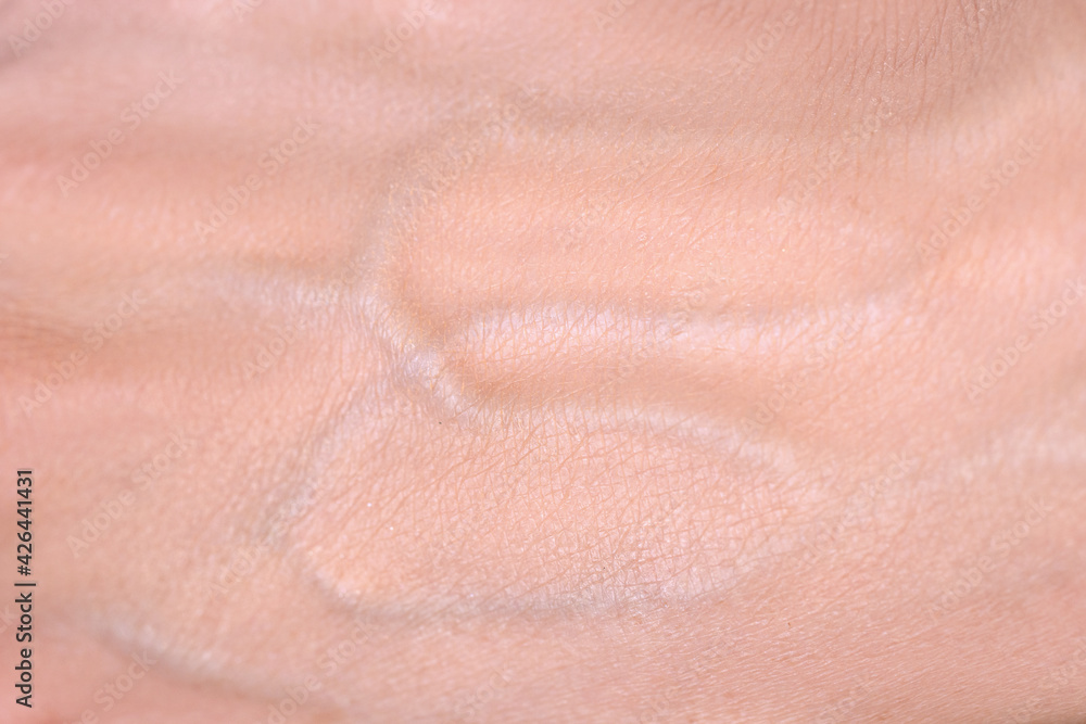 Fototapeta premium Veins on the arm close-up