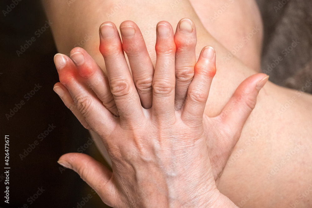 Elderly woman's hands with sore fingers. Finger treatment concept