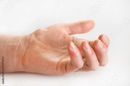 Sick female fingers of an elderly man's hand on a white background