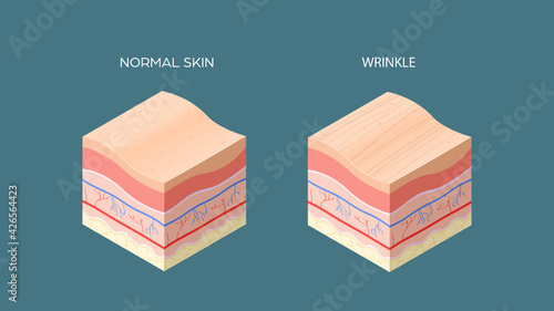 wrinkle and normal skin cross-section of human skin layers structure skincare medical concept flat horizontal