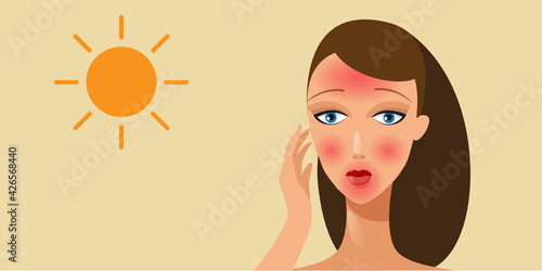woman with red skin after tanning without sun protection girl with redness from sunburn horizontal portrait