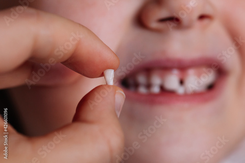 close-up the thumb and index finger hold the fallen or removed baby tooth  the front incisor with the blurred toothless mouth of the child in the background.