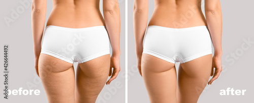 Young woman before and afte...