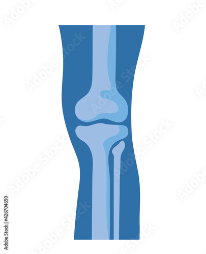 normal knee bones