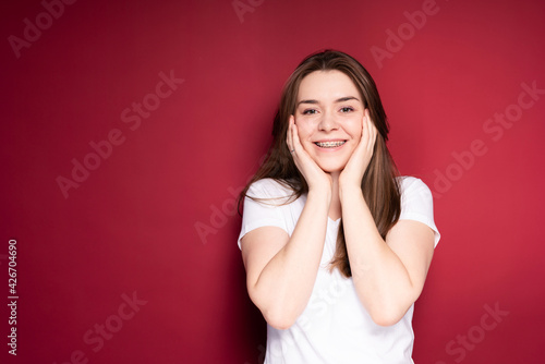 Happy woman in braces and in a white T-shirt smiles broadly, touching her cheeks with her hands