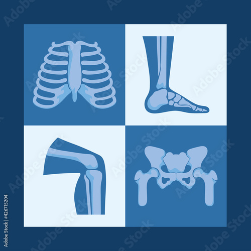 rheumatology bones designs