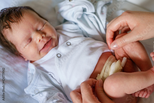 Hands of unknown woman mother caring for umbilical cord with clamp of newborn baby neonatal care parent clean navel of baby on bed at home photo