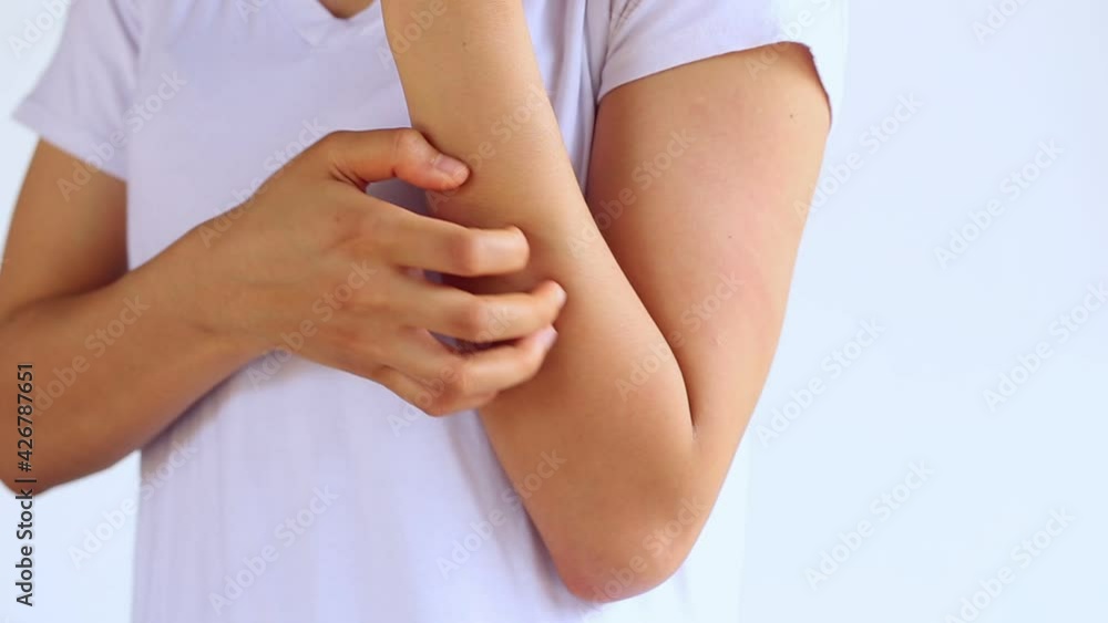 Child scratching arm. Young woman is scratching her arm on the white background. Child scratching arm. Young woman is scratching her arm on the white background.