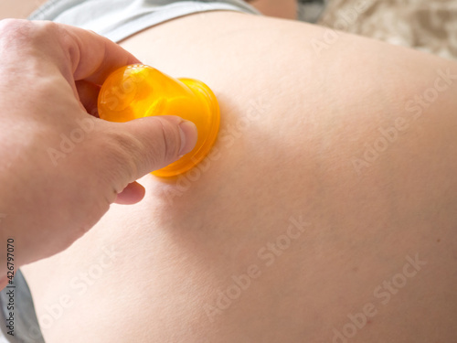 Anti-cellulite hip massage using vacuum cans