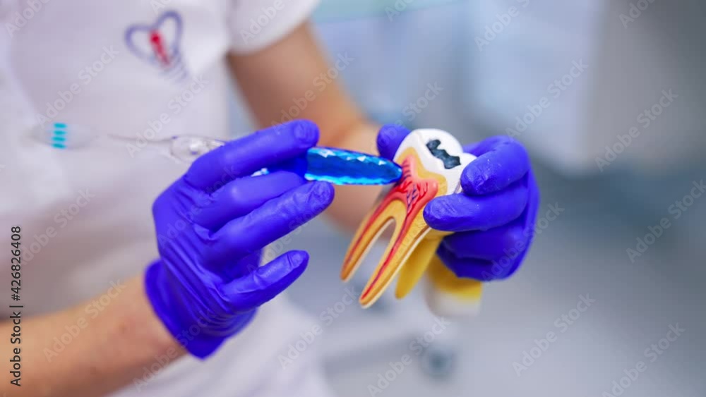Plastic model of tooth. Hands in blue gloves of a professional dentist holding a tooth mock and explaining on it. Close-up. Plastic model of tooth. Hands in blue gloves of a professional dentist holding a tooth mock and explaining on it. Close-up.