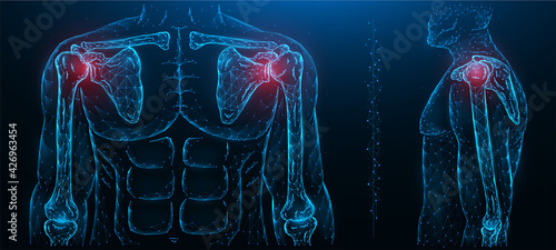 Polygonal vector illustration of a painful shoulder joint. Shoulder joint disease. Diseases of the human musculoskeletal system