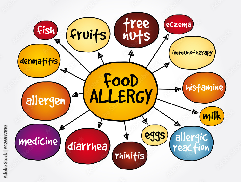 Food allergy mind map, health concept for presentations and reports