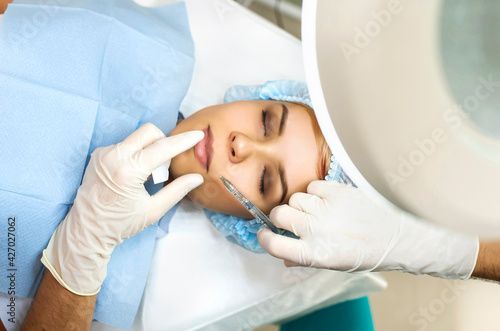 Close up cosmetologist hands in gloves introducing Hyaluronic acid in patient lips with perfect skin.