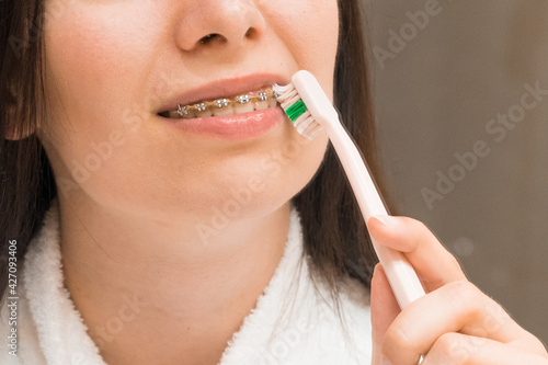 A woman with braces or bracket brushing her teeth with a pink toothbrush in the bathroom. Dental care. Aligning and straightening of teeth. 