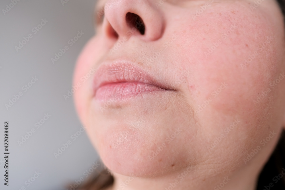 lips, mouth and chin of a middle-aged woman, part of the face close-up, fine wrinkles on the face, spots, the concept of cosmetic anti-aging procedures, facial massage lips, mouth and chin of a middle-aged woman, part of the face close-up, fine wrinkles on the face, spots, the concept of cosmetic anti-aging procedures, facial massage