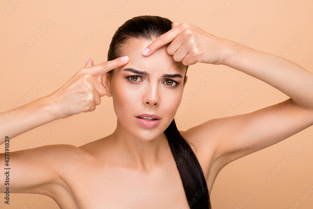 Portrait of attractive naked nude worried girl touching sensitive forehead acne isolated over beige pastel color background Portrait of attractive naked nude worried girl touching sensitive forehead acne isolated over beige pastel color background