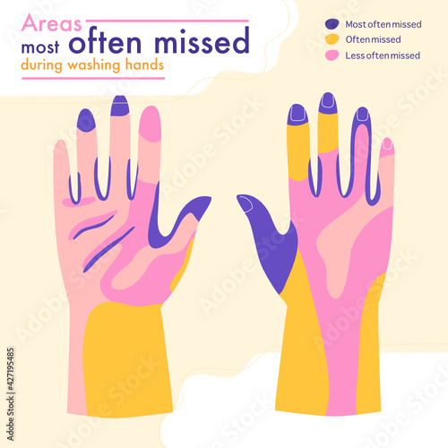 Flat style vector illustration of Area most often missed during washing hands infographic. Concept of how to cleaning hands to avoid germs and virus. 