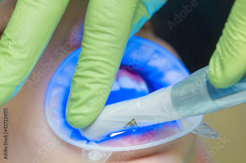 Ultraviolet light for dentistry, blue light for dental treatment.
 photo