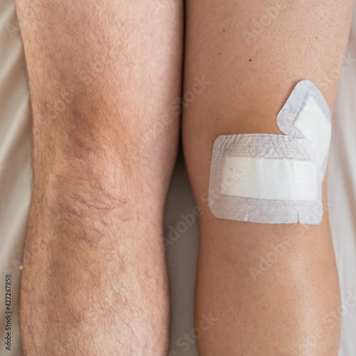 Close-up of male legs with knee taped with tape after laparoscopic minisk surgery photo