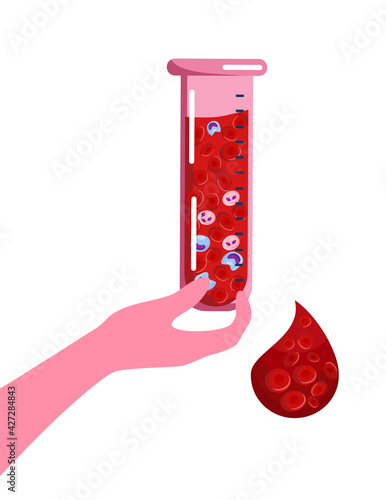 Hand holds laboratory test tube or beaker with sick cells.World Hemophilia Day concept. Coagulation factor and blood clotting problem.Leukosis or anemia illustration. Drop with erytrocytes.Vector,Flat photo