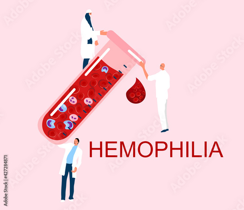 World Hemophilia Day concept. Coagulation factor and blood clotting problem.Laboratory tube with cancer blood full of cells.Tiny doctors make laboratory tests.Leukosis or anemia illustration.