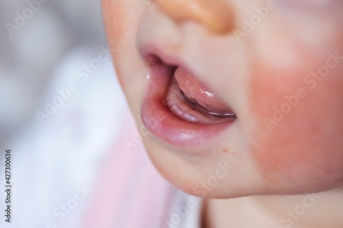 Billede på lærred A macro portrait of a baby mouth with the first two small white teeth coming out of the gums