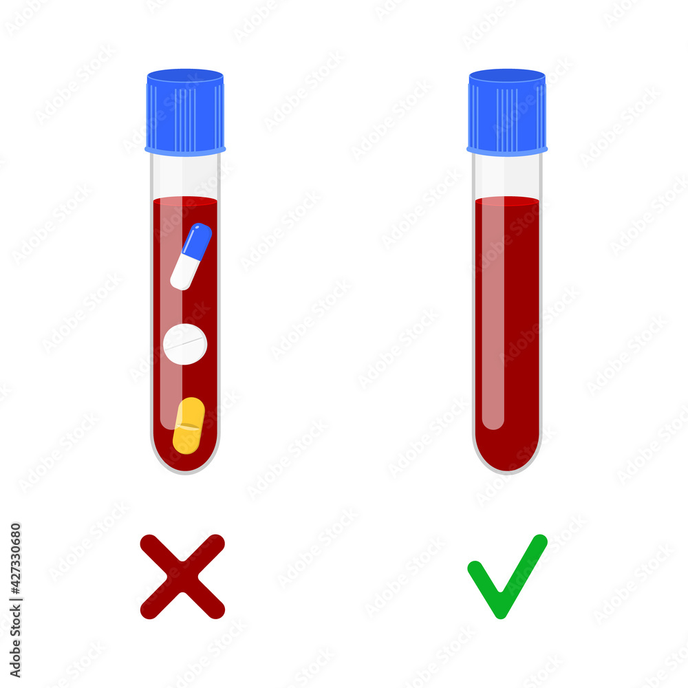 Blood samples with and without drugs. Doping control in sport, post accident drug testing concept. Vector cartoon illustration. Blood samples with and without drugs. Doping control in sport, post accident drug testing concept. Vector cartoon illustration.