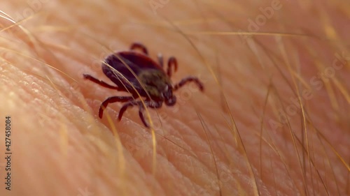 Macro Video of Encephalitis Tick Insect Crawling on Human Skin. Encephalitis Virus or Lyme Borreliosis Disease Infectious Dermacentor Tick Arachnid Parasite. photo