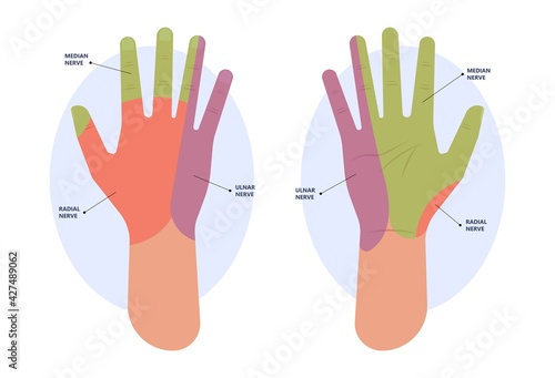 ulnar nerve muscle bone elbow swollen pain hand palm bone spurs ring little medial golfer radial arms wrist funny carpal tennis canal palsy test