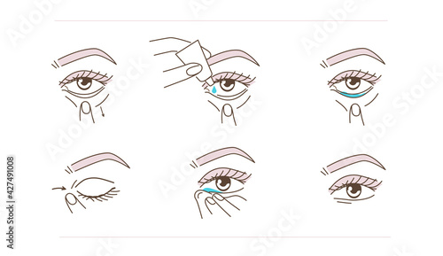 
Woman Using Eye Drops Bottle. Instruction how to Correctly  Applying Eyedrops. Ophthalmology Healthcare against Redness, Allergy, Dry Eyes. Flat Line Vector Illustration and Icons set.