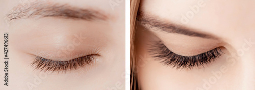 Bild auf Leinwand Eyelash extension procedure before and after