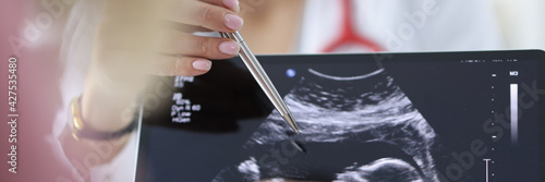 Doctor shows pregnant woman an ultrasound scan of fetus. photo