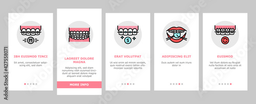 Tooth Braces Accessory Onboarding Mobile App Page Screen Vector. Tooth Braces Installation And Correction, Metal And Sapphire, Ceramic And Plastic Material Illustrations