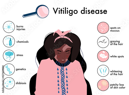 World vitiligo day.Infographics icons with symptoms and reasons of autoimmune sickness.Skin disease.Afro american woman with white spots.Depigmentation problem.Patchy loss of derma color.Vector banner