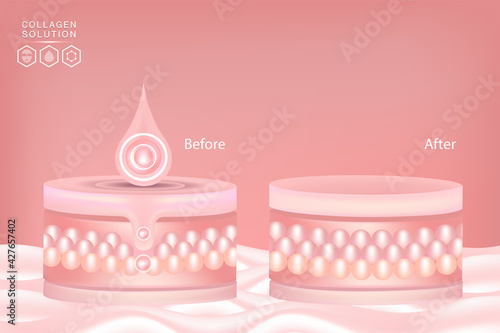 Hyaluronic acid before and after skin solutions ad, pink collagen serum drops with cosmetic advertising background ready to use, illustration vector.