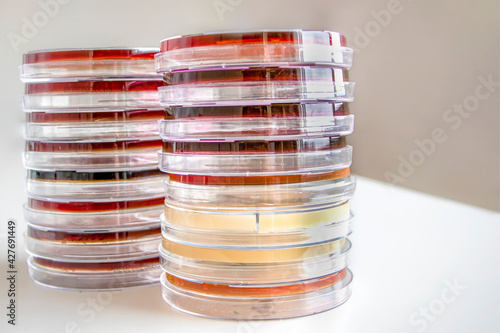 Stack of petry dishes on microbiology laboratory table photo