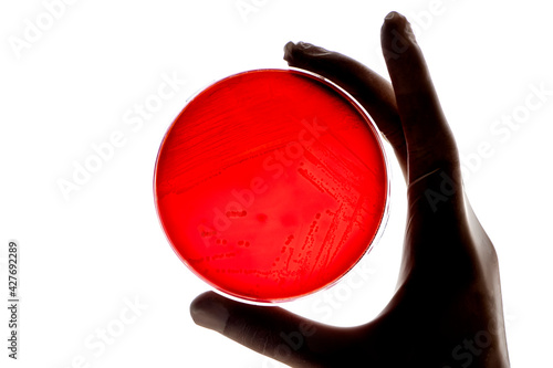 Laboratory technician tests for bacterial infection analyzes bacterial colonies growth Lab worker's hand holds test sample in Petri dishes