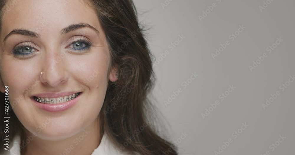 Teeth alignment by braces. Young female smiling friendly. Dental care, orthodontic treatment. Copyspace for advertising Teeth alignment by braces. Young female smiling friendly. Dental care, orthodontic treatment. Copyspace for advertising