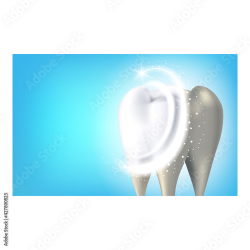 Pro Teeth Whitening Creative Promo Banner Vector. Professional Teeth Enamel Whitening, Dental Clinic Medical Occupation Advertising Poster. Whitest Smile Style Concept Template Illustration