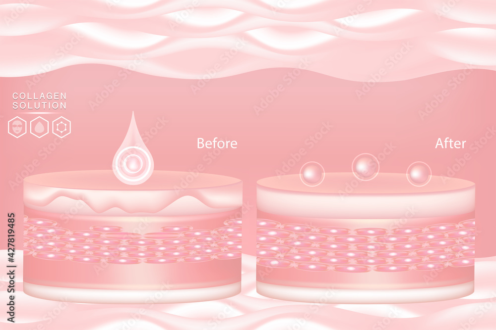 Hyaluronic acid before and after skin solutions ad, pink collagen serum drops with cosmetic advertising background ready to use, illustration vector.