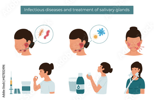 Vector flat illustration of infectious diseases and salivary gland treatment.