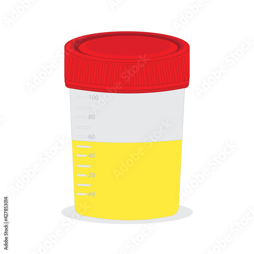 test tubes with blood and a container with urine