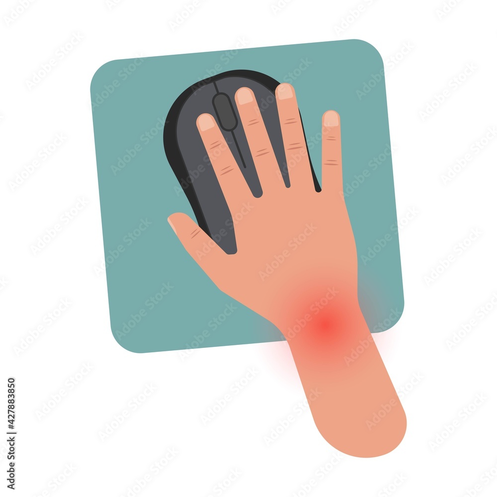 Carpal Tunnel Syndrome Pain Hand Arm Wrist Splint Surgery Bone Flexor Fingers Thumb Muscle Brace Index Middle Ring Work Limb Palm Mouse Keyboard Stock ベクター Adobe Stock