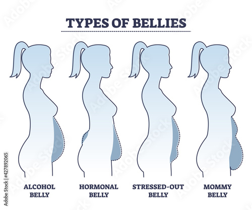 Types of bellies with abdominal fat problem in stomach area outline diagram