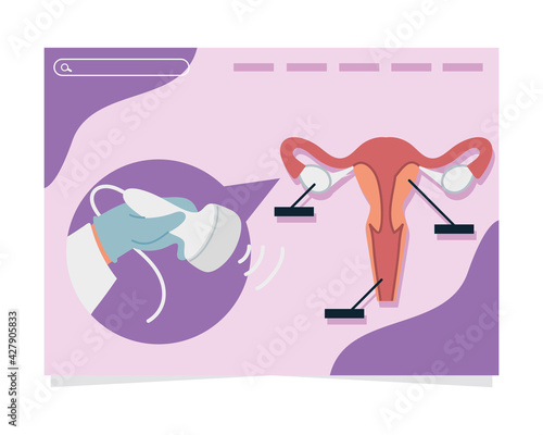 gynecology ultrasound examination